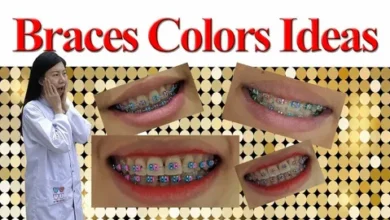 braces colors