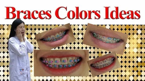 braces colors